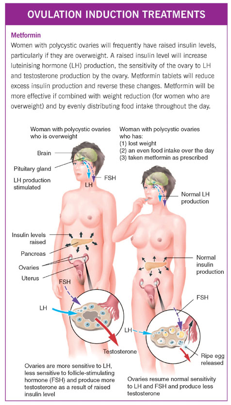 ovulation induction 1