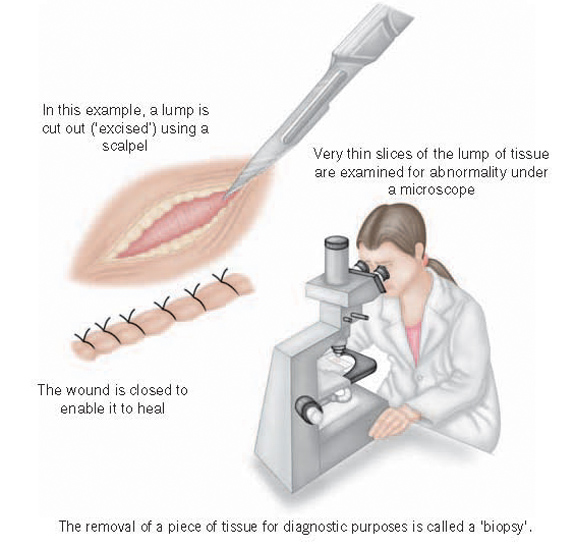 Coding for biopsies in ICD-10-PCS - www.hcpro.com